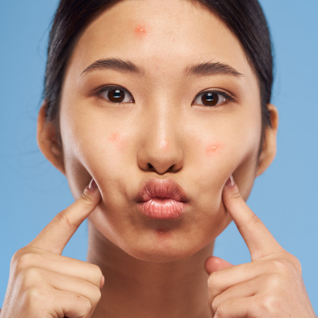 Face Mapping : comprendre vos imperfections